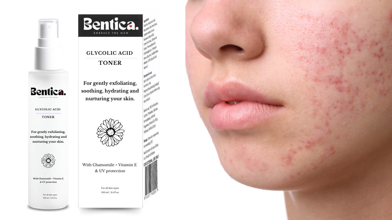 Does the HydraFresh toner help balance pH levels, and how does it benefit acne-prone skin? bentica.