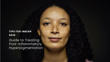 Post-inflammatory hyperpigmentation on Indian skin illustration